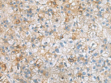 IGLL1 Polyclonal Antibody Reactivity Human