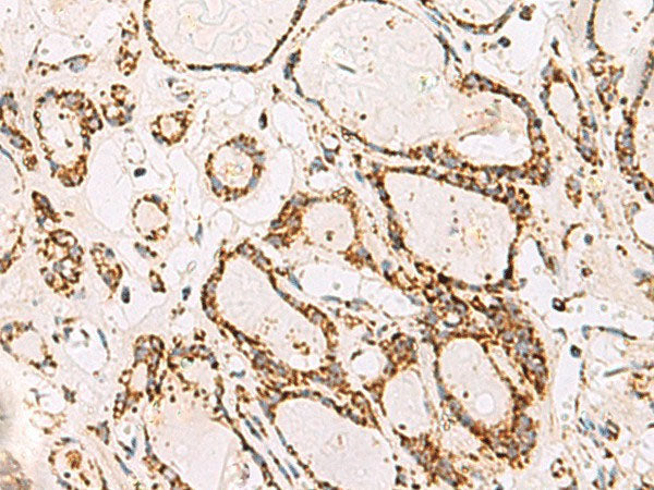 ATP5O Polyclonal Antibody Reactivity Human