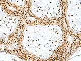 PRPF40A Polyclonal Antibody Reactivity Human