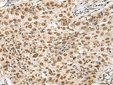 PRPF40A Polyclonal Antibody Reactivity Human