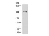 PRPF40A Polyclonal Antibody Reactivity Human