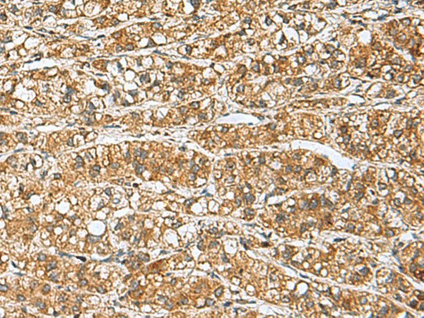 GINS3 Polyclonal Antibody Reactivity Human
