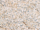 SLC30A6 Polyclonal Antibody Reactivity Human