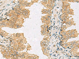 SLC30A6 Polyclonal Antibody Reactivity Human