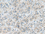 RPL10A Polyclonal Antibody Reactivity Human