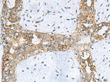 RPL10A Polyclonal Antibody Reactivity Human