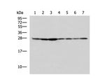 RPL10A Polyclonal Antibody Reactivity Human