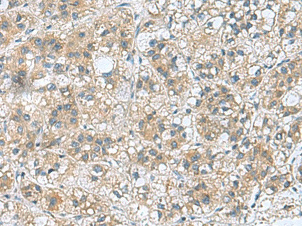 RAB39A Polyclonal Antibody Reactivity Human