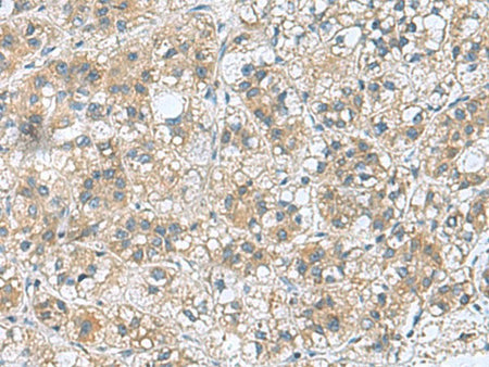 RAB39A Polyclonal Antibody Reactivity Human