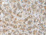TMED10 Polyclonal Antibody Reactivity Human