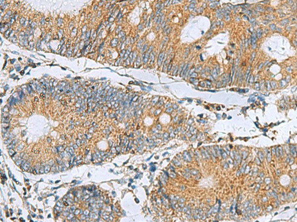 TMED10 Polyclonal Antibody Reactivity Human