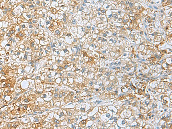 UCHL1 Polyclonal Antibody Reactivity Human