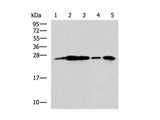 UCHL1 Polyclonal Antibody Reactivity Human