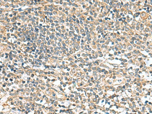 CCDC134 Polyclonal Antibody Reactivity Human