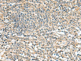 CCDC134 Polyclonal Antibody Reactivity Human