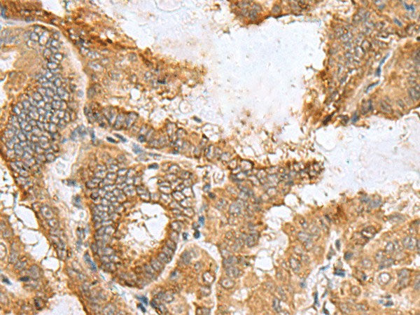CCDC134 Polyclonal Antibody Reactivity Human