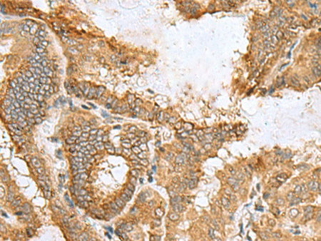 CCDC134 Polyclonal Antibody Reactivity Human