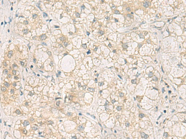 LRAT Polyclonal Antibody Reactivity Human