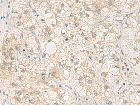 LRAT Polyclonal Antibody Reactivity Human