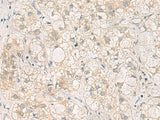 LRAT Polyclonal Antibody Reactivity Human