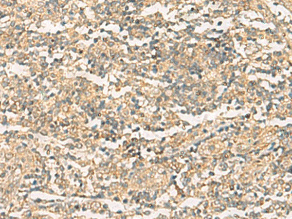 NQO2 Polyclonal Antibody Reactivity Human