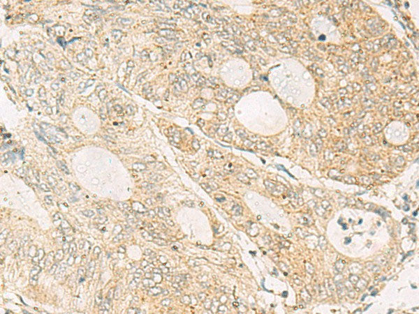 NQO2 Polyclonal Antibody Reactivity Human