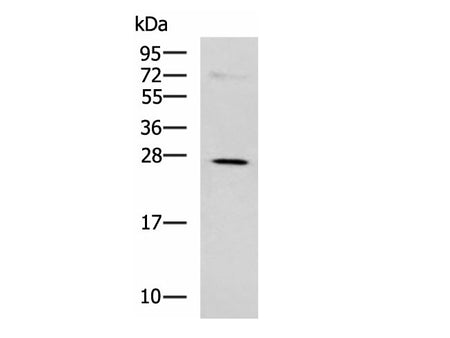 NQO2 Polyclonal Antibody Reactivity Human