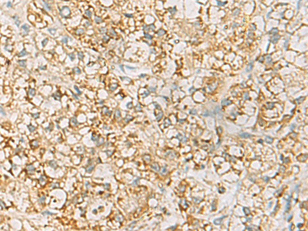 HLA-DQB2 Polyclonal Antibody Reactivity Human