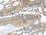 PAFAH1B3 Polyclonal Antibody Reactivity Human