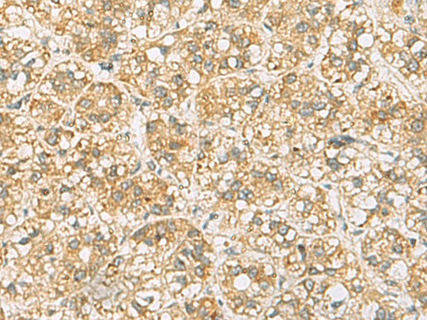 FAAP100 Polyclonal Antibody Reactivity Human