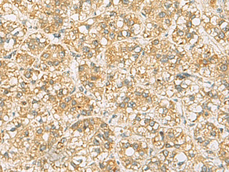 FAAP100 Polyclonal Antibody Reactivity Human