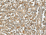 RAB23 Polyclonal Antibody