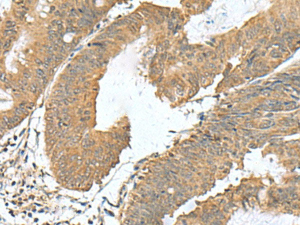 RAB23 Polyclonal Antibody