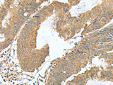 RAB23 Polyclonal Antibody