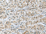DNAJA4 Polyclonal Antibody Reactivity Human, Biomarkers, Elabscience Biotechnology, MSE Supplies