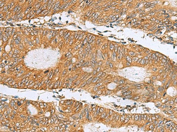 DNAJA4 Polyclonal Antibody Reactivity Human