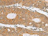 DNAJA4 Polyclonal Antibody Reactivity Human