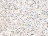 ANKS6 Polyclonal Antibody