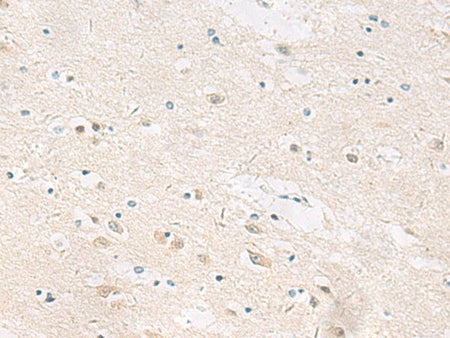ANKS6 Polyclonal Antibody