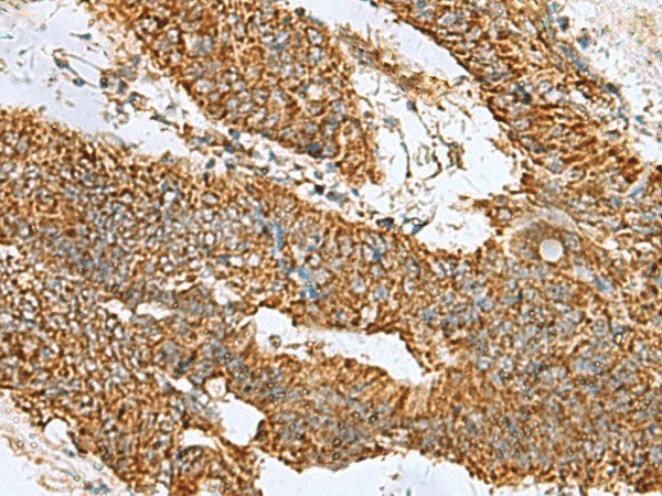 PREPL Polyclonal Antibody Reactivity Human – MSE Supplies