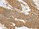 PREPL Polyclonal Antibody Reactivity Human