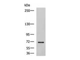 PREPL Polyclonal Antibody Reactivity Human