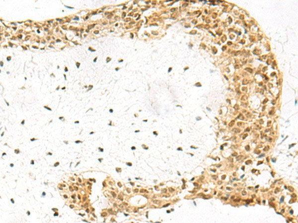 EXOSC4 Polyclonal Antibody Reactivity Human