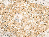 EXOSC4 Polyclonal Antibody Reactivity Human