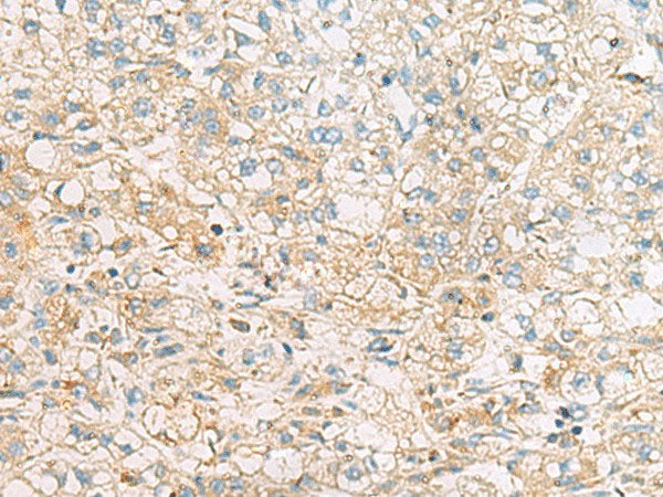 EIF4E2 Polyclonal Antibody