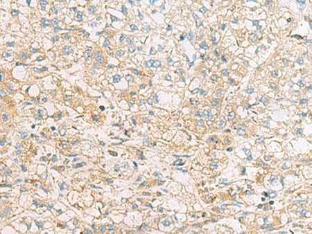 EIF4E2 Polyclonal Antibody