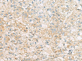EIF4E2 Polyclonal Antibody