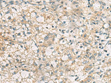 RTP4 Polyclonal Antibody Reactivity Human