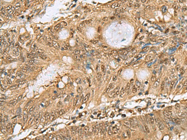 PSMA6 Polyclonal Antibody Reactivity Human