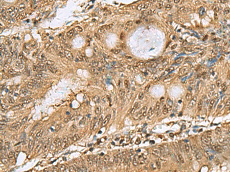 PSMA6 Polyclonal Antibody Reactivity Human